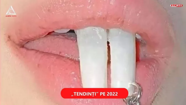 O noua moda socheaza lumea