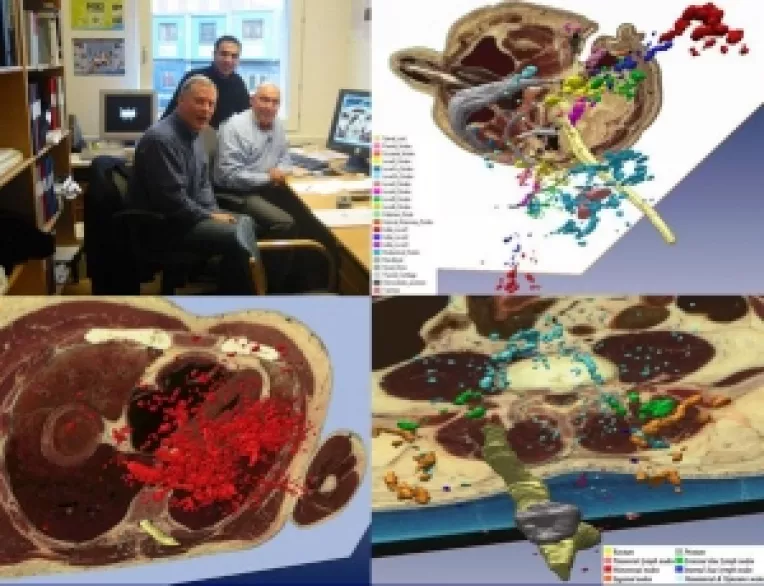 Un interviu exceptional cu prof. univ.dr. Ion-Christian Chiricuta, cel mai bun medic primar de radioterapie din Romania (4)